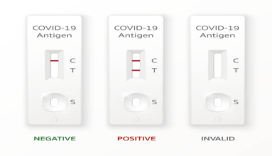 A picture of diffrent antigent test for covid-19 showing the positive and negative lines