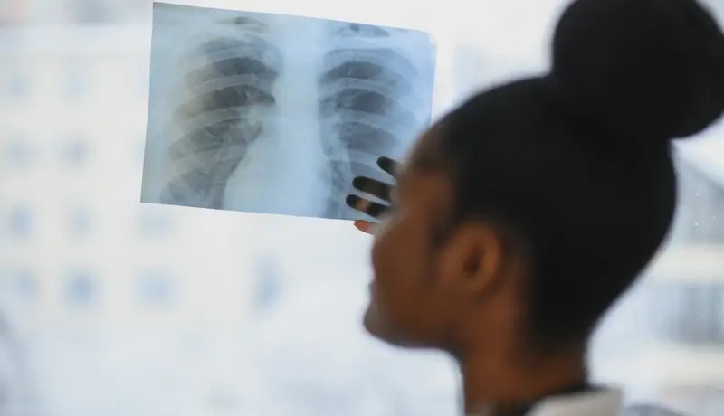 A doctor holding a chest X-ray up to the light for pneumonia evaluation.